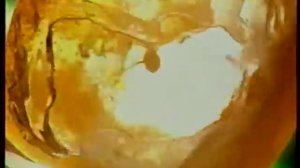 Рекламный блок + анонс сериала «Боец» (Ren-TV, ноябрь 2004)