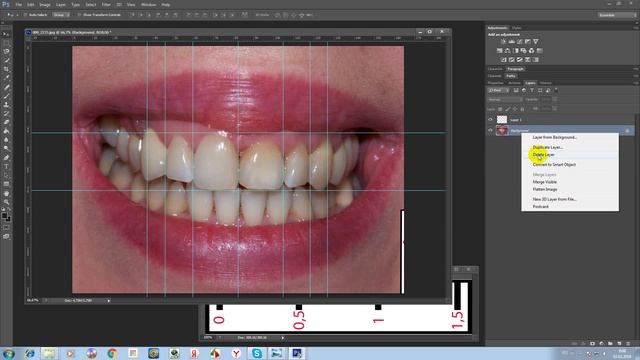 Digital Smile Design по-русски - часть 1 смотреть онлайн