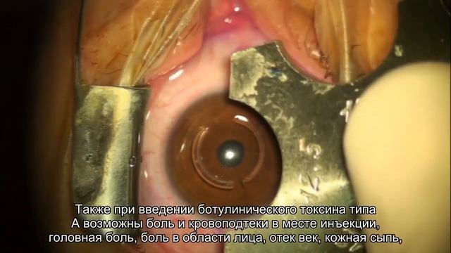 Будьте осторожны с инъекциями красоты смотреть онлайн