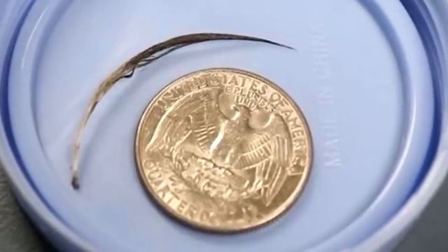 Этот ребёнок постоянно чесал шею. Причина удивила даже бывалых врачей!