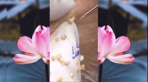 Выдавливание чёрных точек НОВОЕ! Удаление чёрных точек за ухом. p11