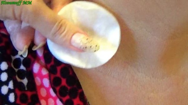 ПОМАЖЬ этим маслом и папилломы отсохнут!!! БЕЗОПАСНОЕ удаление папиллом ДОМА.