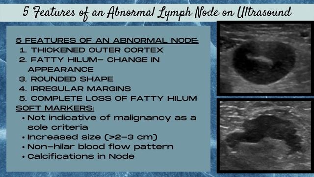 Breast Ultrasound (Features of an Abnormal Lymph Node) смотреть онлайн