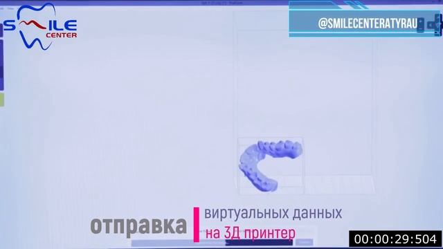 3D печать Коронки зубов Атырау стамотология смотреть онлайн