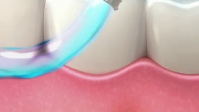 асепта 2011 смотреть онлайн