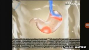 Реклама Маалокс сила в двух компонентов 2016