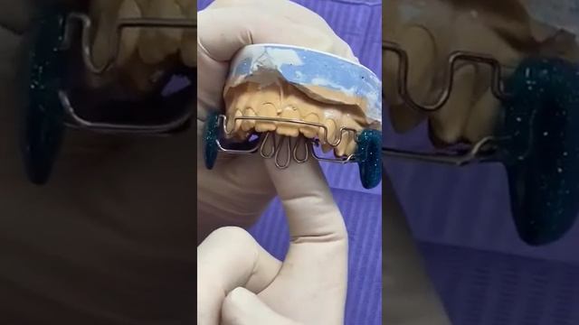 Аппарат Планас смотреть онлайн