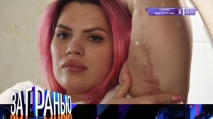 «За гранью»: «Шрамы вместо талии» | Остросоциальное ток-шоу с Сергеем Соседовым на НТВ