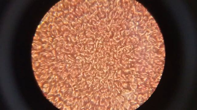 Кровь после цикория. Что изменится? смотреть онлайн