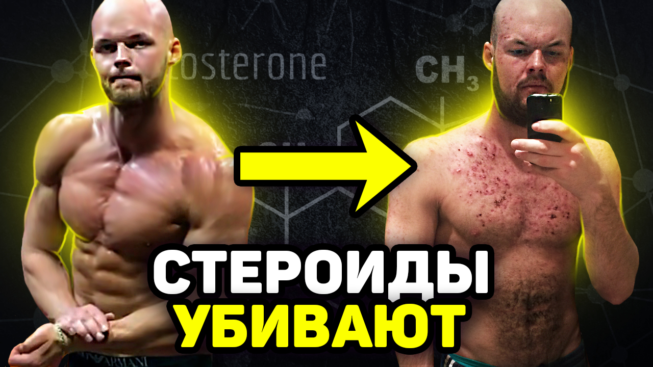 Я КОЛОЛ 3 ГОДА СТЕРОИДЫ И ЧУТЬ НЕ УМЕР. МОЯ УЖАСНАЯ ИСТОРИЯ смотреть онлайн