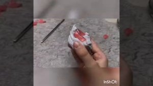 Этапы изготовления бюгельного протеза