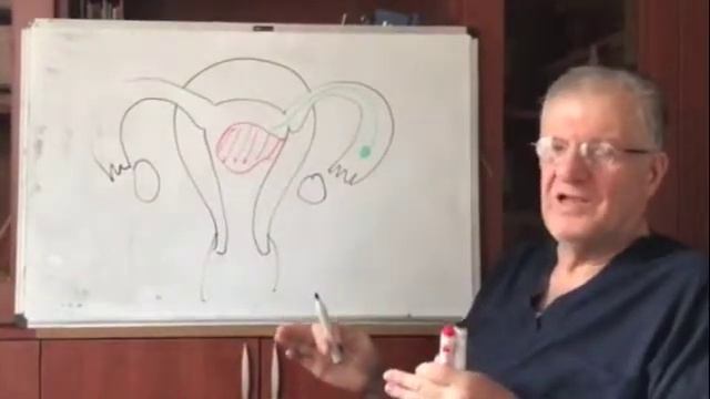 субмукозная миома полости матки смотреть онлайн