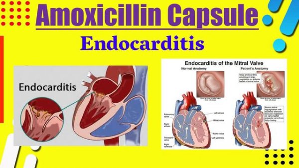 amoxicillin 500mg capsule | cipmox 500 mg | amoxicillin capsules