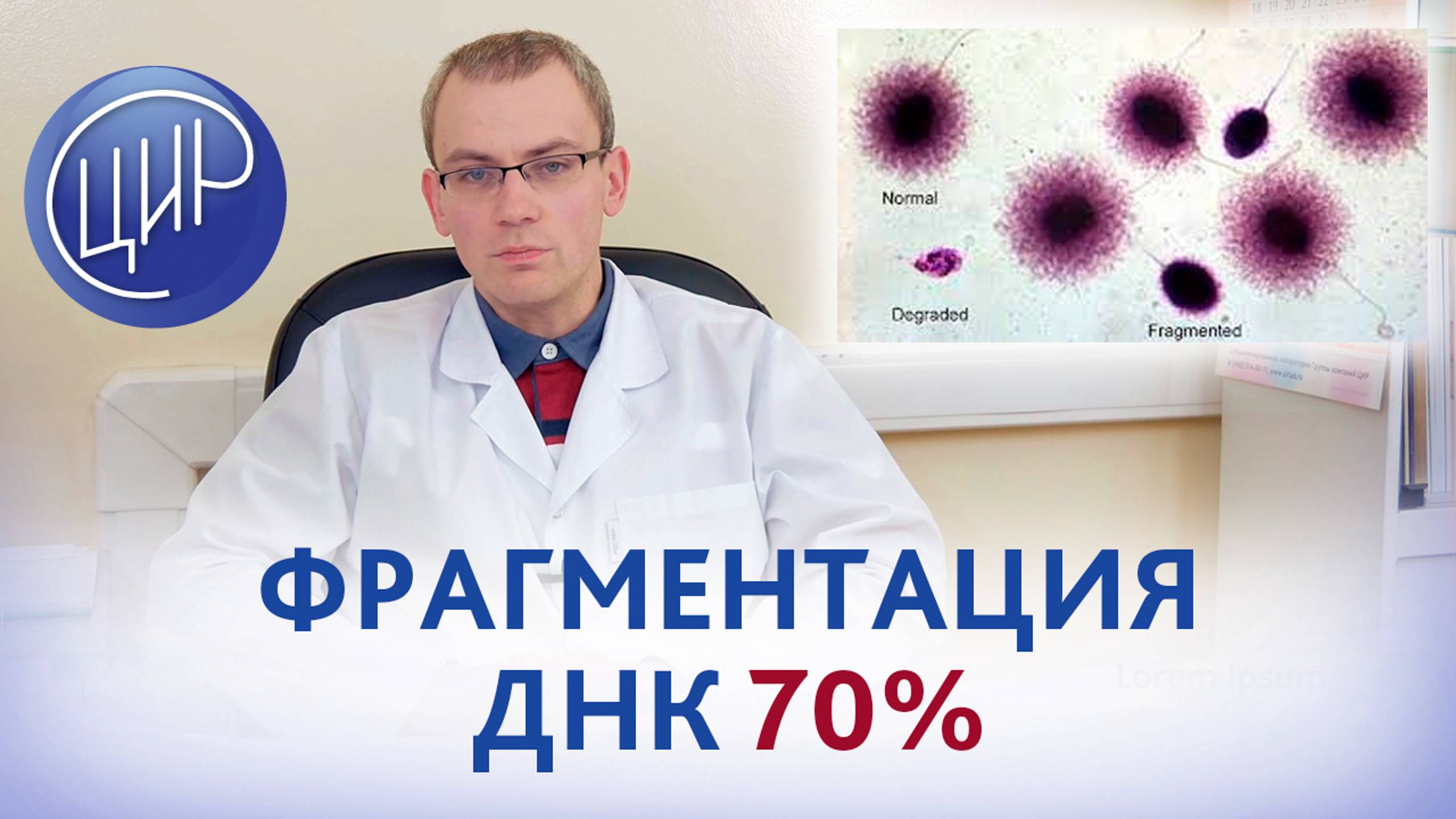 Бесплодие с высоким уровнем фрагментации ДНК сперматозоидов. Что делать? Андролог Живулько А.Р. смотреть онлайн