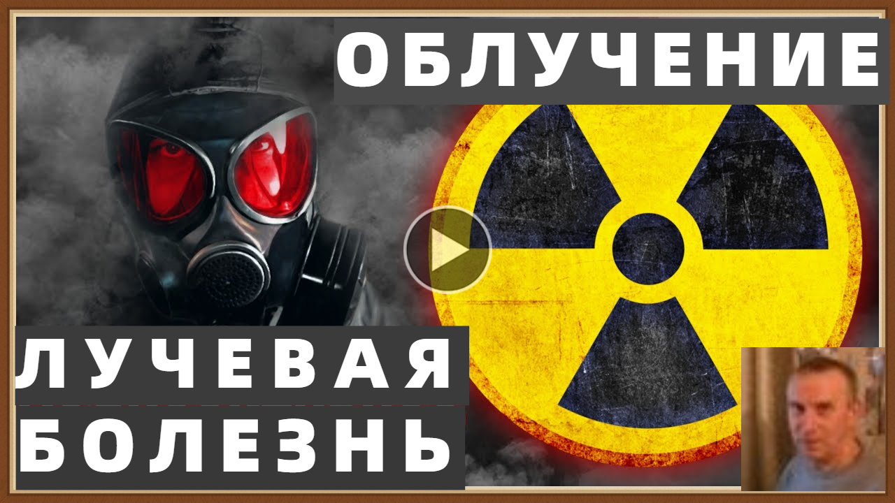 ОБЛУЧЕНИЕ - ЛУЧЕВАЯ БОЛЕЗНЬ смотреть онлайн