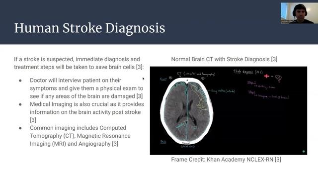 CMPE 298 Special Problems: Preparing Stroke Medical Imaging Data For AI Diagnosis смотреть онлайн