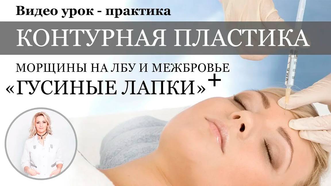 Заполнение морщин на лбу и возле глаз филлерами (Princess Filler) смотреть онлайн