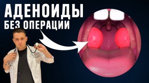 Как вылечить Аденоиды у ребенка без операции?