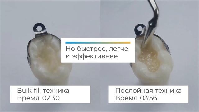SDR plus - текучий композит объемного внесения! смотреть онлайн