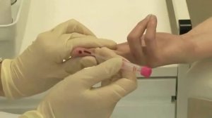 Техника взятия капиллярной крови Sarstedt