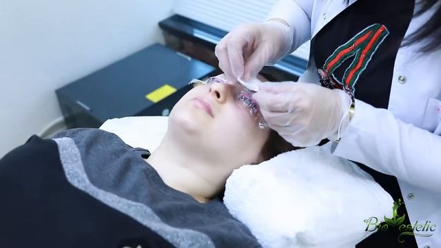 Kiprik Laminasiyası смотреть онлайн