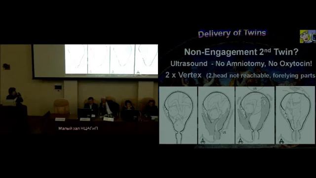 Внутриутробное сосотояние плода при двойне проф Арабин Биргит смотреть онлайн