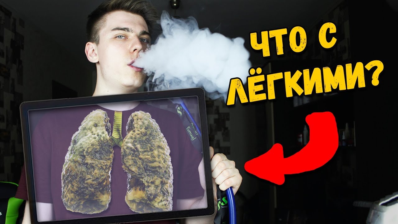 Курю кальян 4 года Мои лёгкие Последствия смотреть онлайн