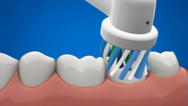 Electric toothbrushes reduce gingivitis and provide plaque removal смотреть онлайн