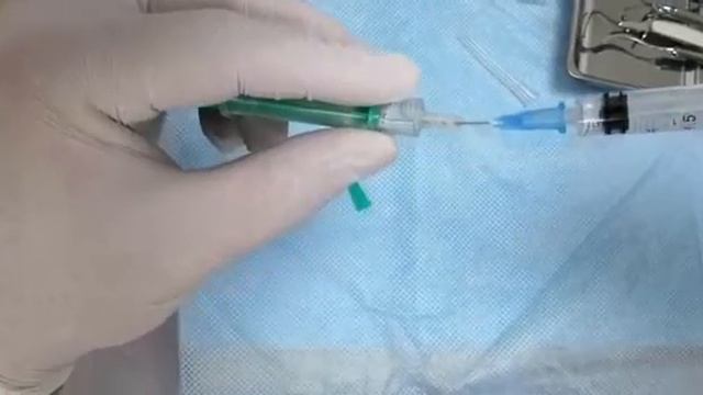 Использование _Сульфакрилата_ в стоматологии. смотреть онлайн