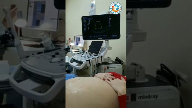 💻_ УЗИ при беременности смотреть онлайн