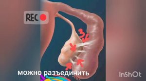 МАТОЧНЫЕ ТРУБЫ: СТРОЕНИЕ, ФУНКЦИИ, ГИДРОСАЛЬПИНКС