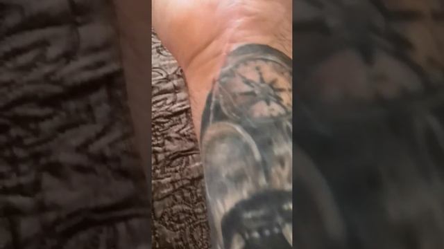 Повреждение срединного нерва кисти и сухожилий сгибателей и разгибателей пальцев. 1ч смотреть онлайн