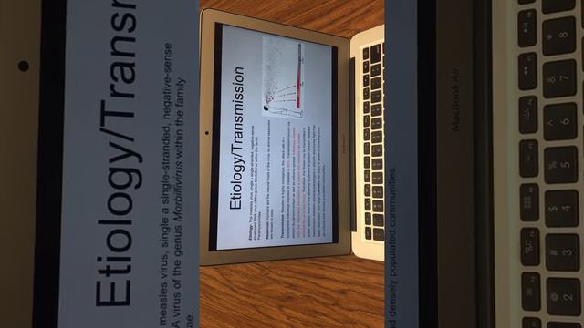Measles Virus Presentation--BIO 221 смотреть онлайн