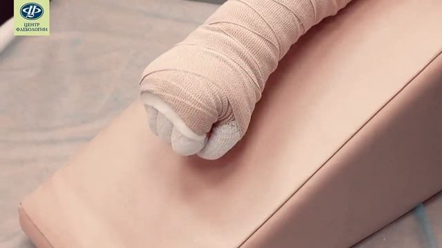 6 упражнений в бандаже при лимфедеме рук смотреть онлайн