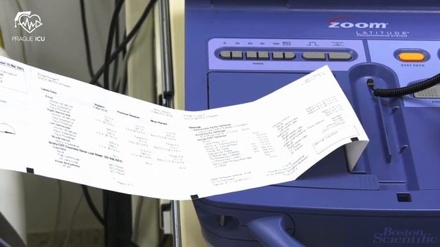 Deactivation and reactivation of ICD смотреть онлайн