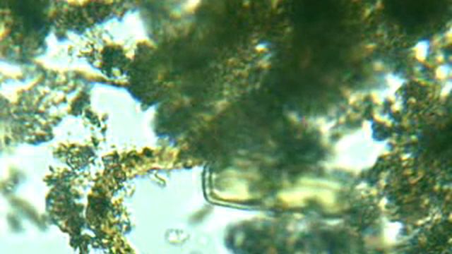 Mikroskop - Längliches Tierchen 4 ( 40x Auflösung ) смотреть онлайн