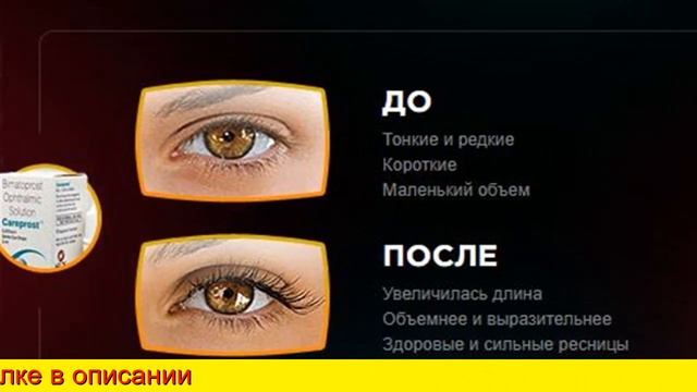Карепрост Для Ресниц Отзывы Фото смотреть онлайн