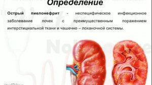 Лекция 2, 3 курс. Тема 1.5 Тактика фельдшера при МКБ. Почечная колика. Остром пиелонефрите