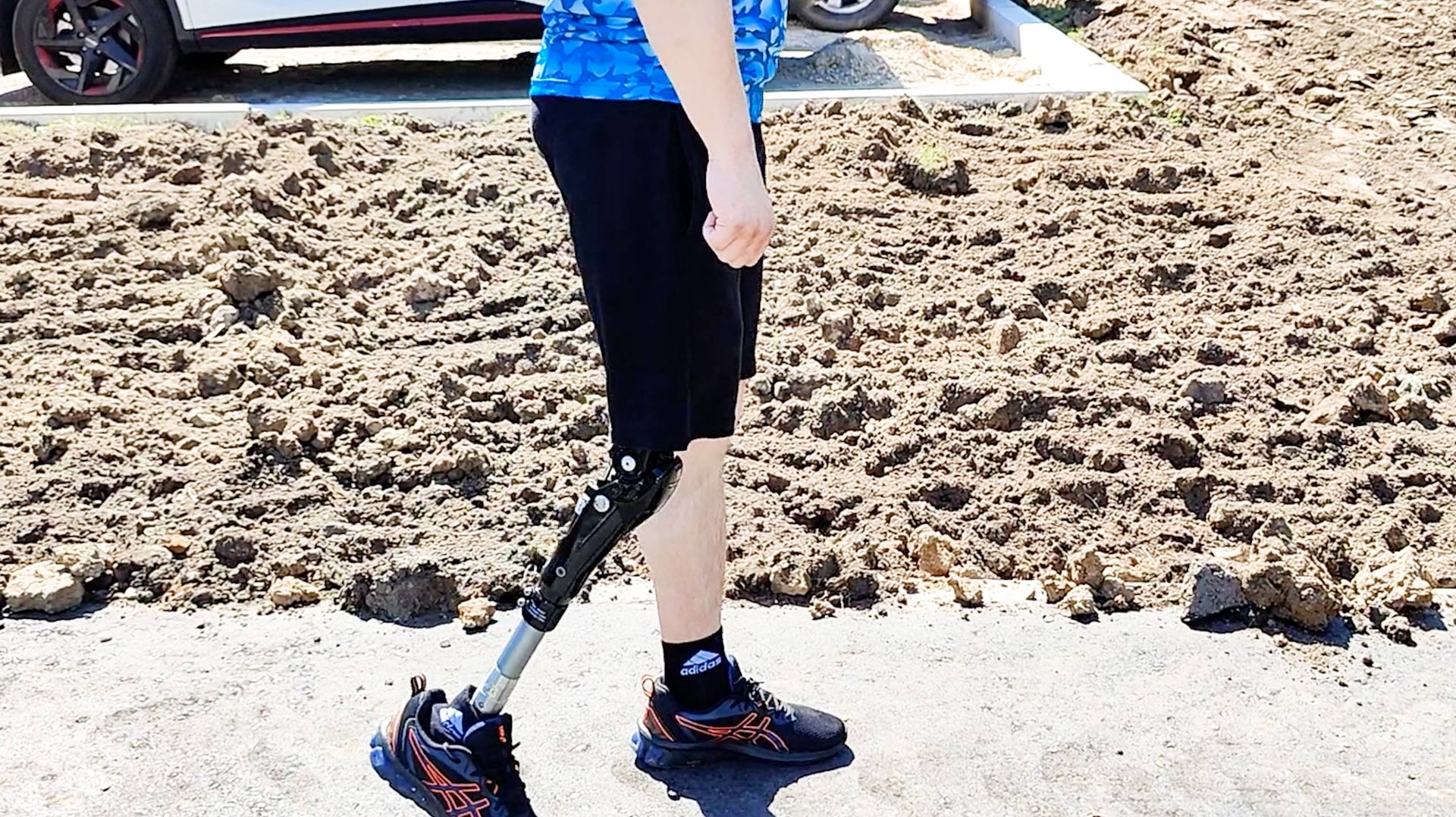 Впервые на протезе бедра с микропроцессором. смотреть онлайн