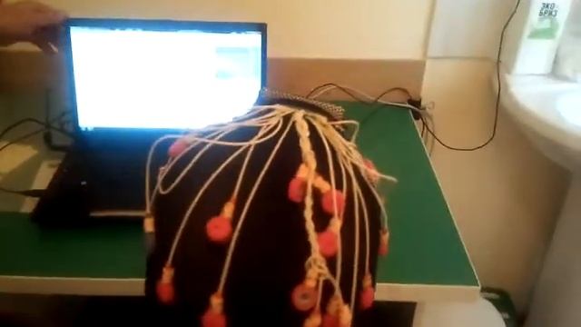 Беспроводной ЭЭГ на приборе «НейТи» смотреть онлайн