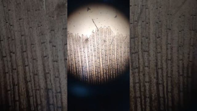 Gyrodactylus :: wet mount смотреть онлайн