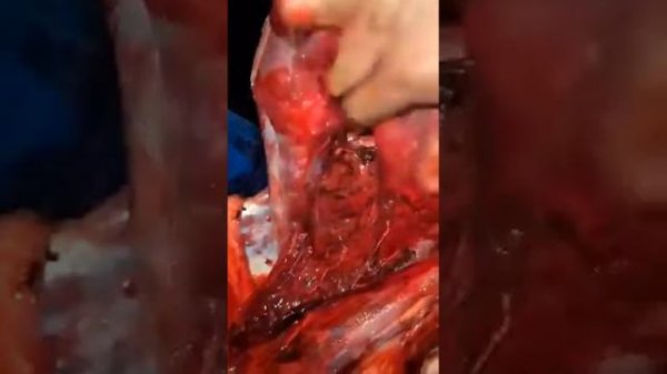 6.5 300 weatherby magnum mark v 156 grain berger bullet performance expansion.