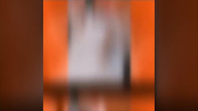 ЛАЗЕРНАЯ ЭПИЛЯЦИЯ для мужчин и женщин смотреть онлайн