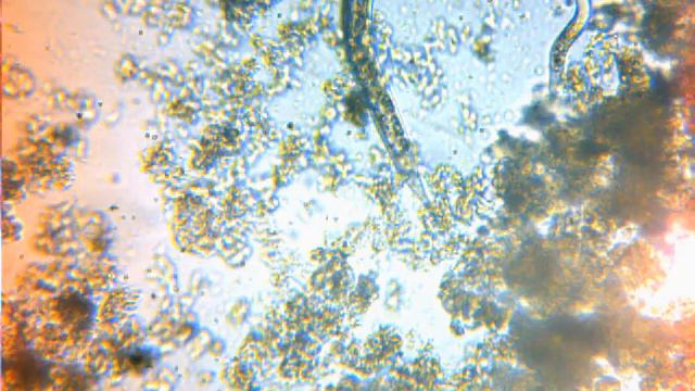Микрофауна в унитазе.avi, Microfauna in water-closet.avi смотреть онлайн