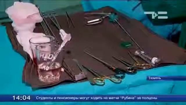 В Тюмени официально открылся центр торакальной хирургии смотреть онлайн