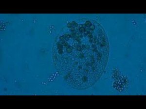 Смерть инфузории. Как вода может убить  инфузорию.