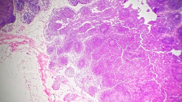 Lymph node in section filmed under microscope 40x on bright field background смотреть онлайн