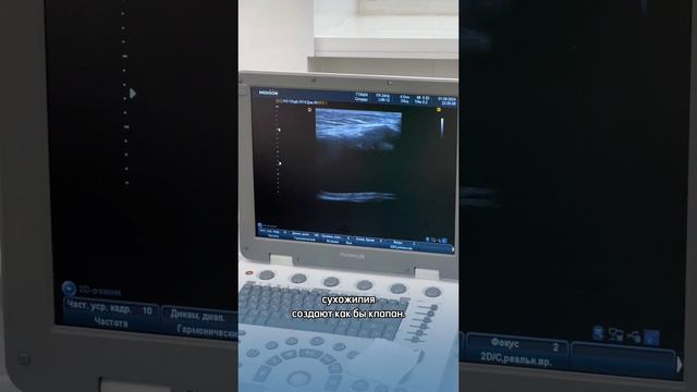 Операция по удалению Кисты Бейкера