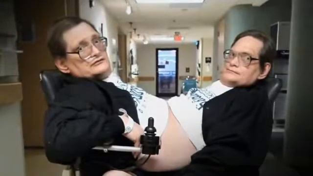 Сиамские близнецы Моя Ужасная История смотреть онлайн