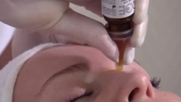 Пилинг PQ Age. Протокол процедуры